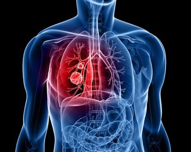 Parasiten in der Lunge