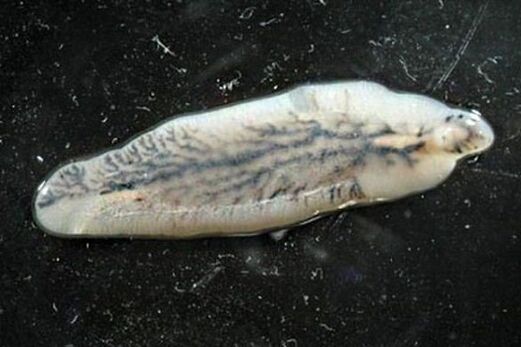 Leberegel beim Menschen