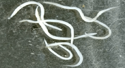 Madenwürmer im menschlichen Körper