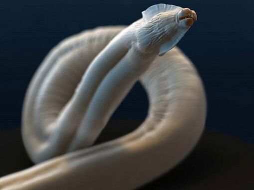 Toxocara aus dem menschlichen Körper