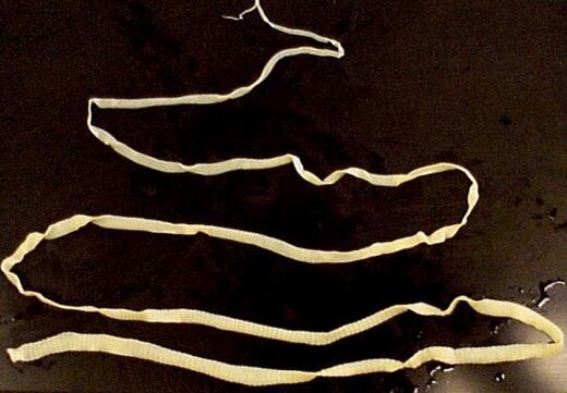 breiter Bandwurm aus dem menschlichen Körper