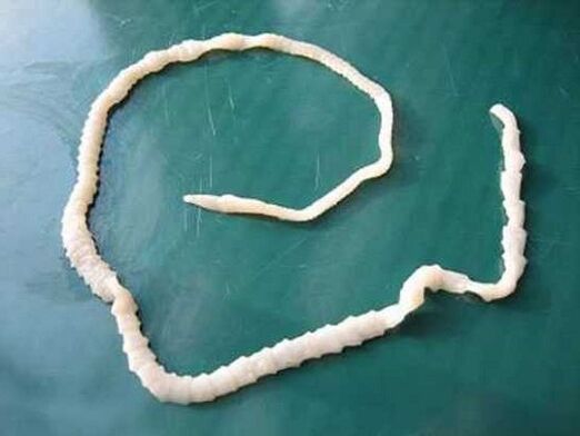 menschlicher Schweinebandwurm