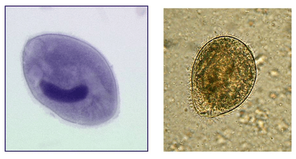 Balantidia ciliates, Parasit im Dickdarm